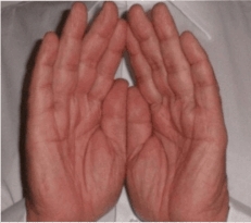 o quê é Reiki